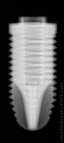 Radiograph of Osseous Maxi PS