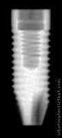 Radiograph of Anthofit OI Straight