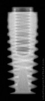 Radiograph of Osseous Quattro Standard