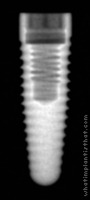Radiograph of Anthofit OI Tapered