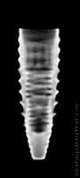 Radiograph of INNO Submerged Narrow