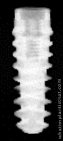 Radiograph of BLX Roxolid RB