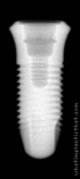 Radiograph of Ossfit Aesthetic