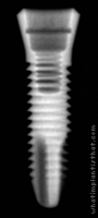 Radiograph of Ossfit Standard