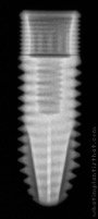 Radiograph of InHex Standard