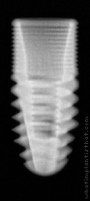 Radiograph of InHex Maxi