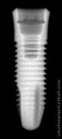 Radiograph of Ossfit Standard