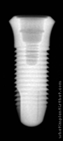 Radiograph of Ossfit Standard