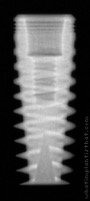 Radiograph of InHex Quattro Standard