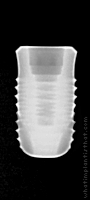 Radiograph of INNO Internal