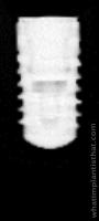 Radiograph of Bone Level RC