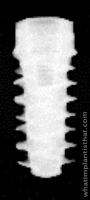 Radiograph of BLX Roxolid WB