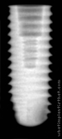 Radiograph of Axiom REG
