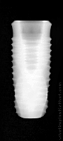 Radiograph of INNO Internal