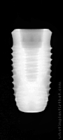 Radiograph of INNO Internal