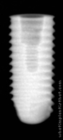 Radiograph of Axiom REG