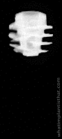 Radiograph of BLX Roxolid WB