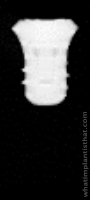 Radiograph of Standard Plus WN