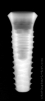Radiograph of INNO Internal