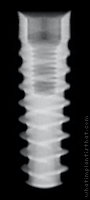 Radiograph of Dynamic