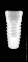 Radiograph of INNO Internal