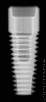 Radiograph of Integrity Tapered