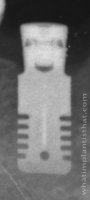 Radiograph of Rex TL 1.8