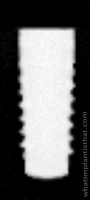 Radiograph of Pure Ceramic Monotype ND