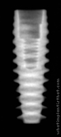 Radiograph of Axiom PX