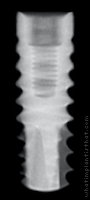 Radiograph of Shark
