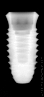 Radiograph of INNO Internal