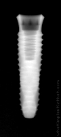 Radiograph of INNO Internal