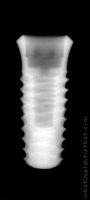 Radiograph of INNO Internal