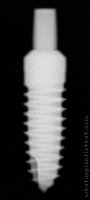 Radiograph of One-Piece Tapered (CB)