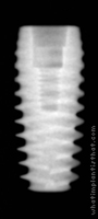 Radiograph of Axiom PX