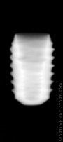 Radiograph of INNO Submerged