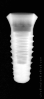 Radiograph of INNO Internal