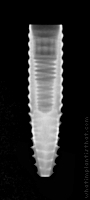 Radiograph of INNO Submerged Narrow