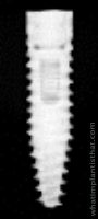 Radiograph of Bone Level Tapered NC