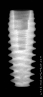 Radiograph of Axiom PX