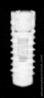 Radiograph of Bone Level NC