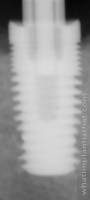 Radiograph of Inclusive