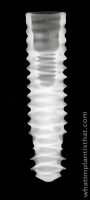 Radiograph of Neodent Helix GM Narrow