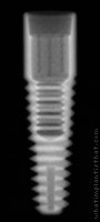 Radiograph of Integrity Tapered