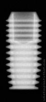 Radiograph of P Form