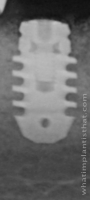Radiograph of Rex BL 2.9