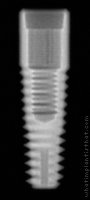 Radiograph of Integrity Tapered