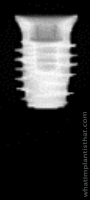 Radiograph of Neodent Helix Short