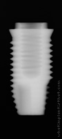 Radiograph of US II Plus