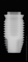 Radiograph of US II Plus RBM
